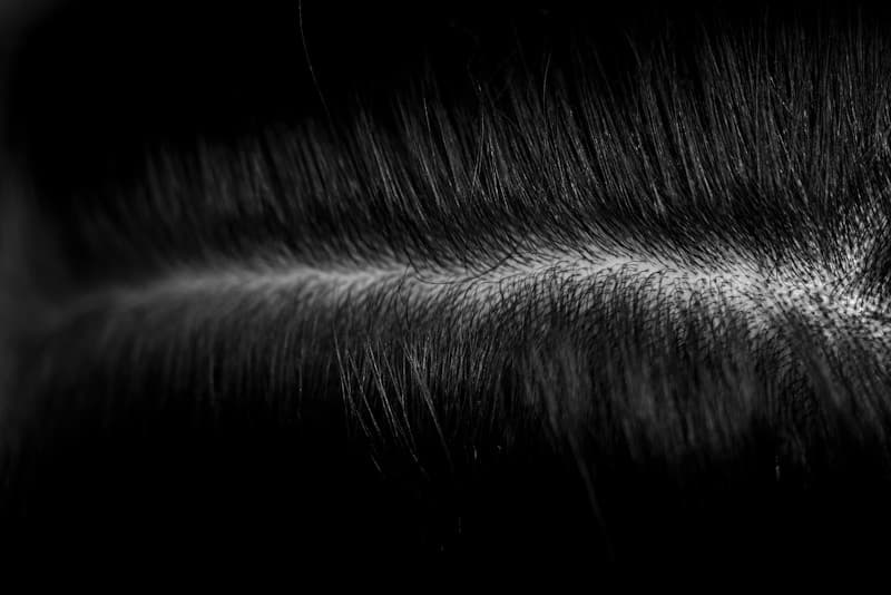 Hair Transplantation