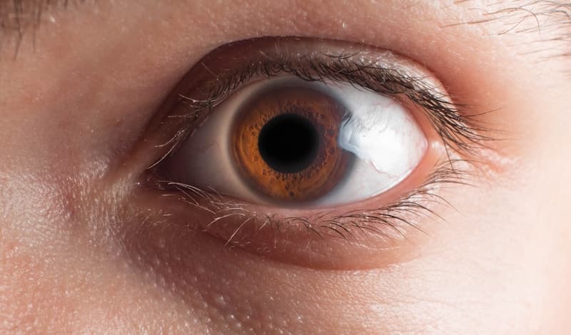 Eyelid Aesthetics